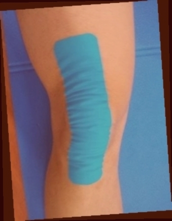 Où passer commande pour Genouillère Quadriceps ?