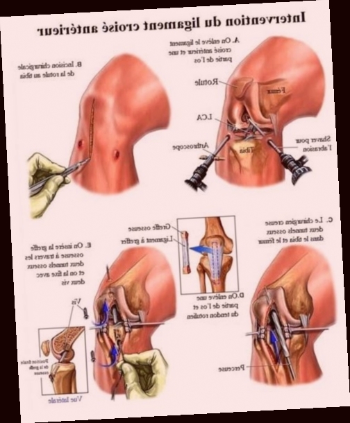 Où passer commande pour Genouillère Quadriceps ?